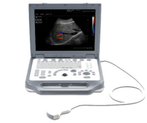 Portable Color Doppler Ultrasound System UScan D G30