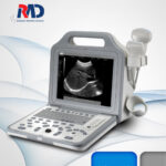 Portable Fully Digital B/W Ultrasound System - UScan N2