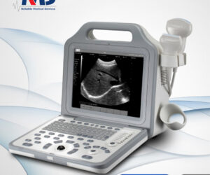 Portable Fully Digital B/W Ultrasound System - UScan N2